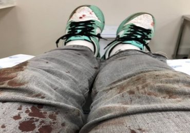 pes-iloveimg-resized