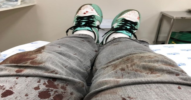 pes-iloveimg-resized