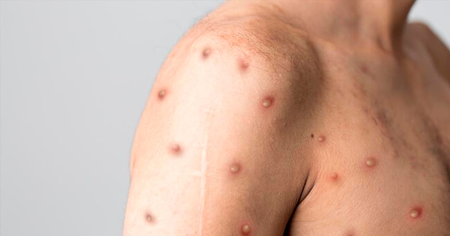 01 - 2022-08-23T092053.650